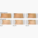 FreezeFrame TUMMY TUCK 100ml